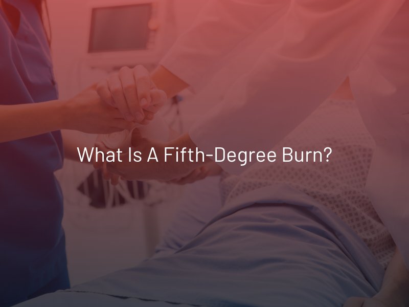 What is a Fifth-Degree Burn?
