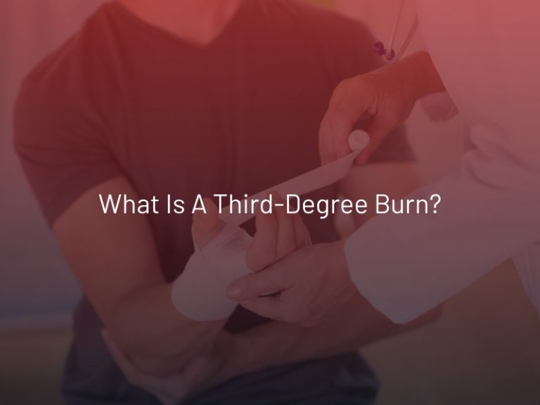 What Is A Third Degree Burn 7529