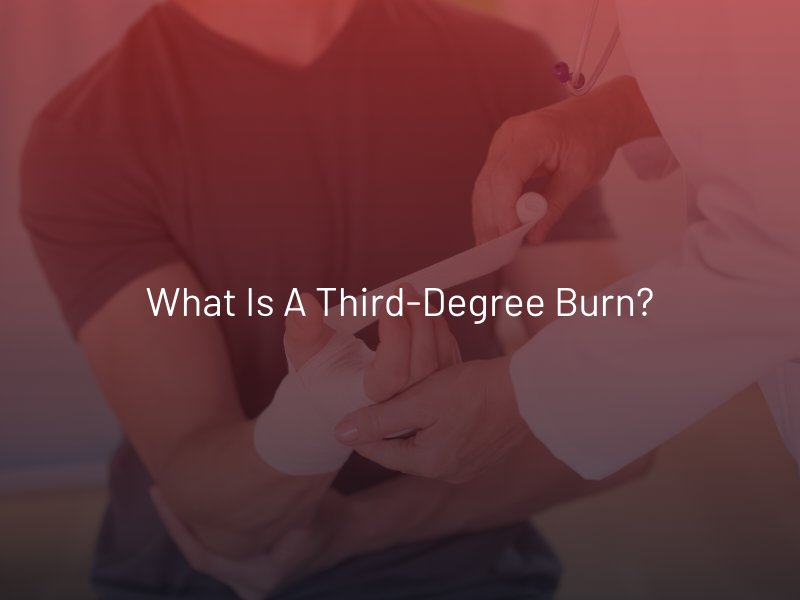 What is a Third-Degree Burn?